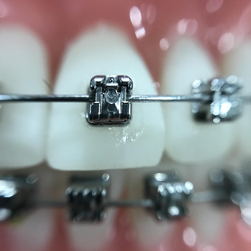 best dental chain Kolkata, best dental clinic, best dental clinic in Kolkata, best dental clinic in Kolkata, best dental hospital in Kolkata, best dentist in Kolkata, dental clinic in Kolkata, dental clinic in Kolkata, dental solutions clinic in Kolkata, dental solutions in Kolkata, dental treatment in Kolkata, famous dental hospital in Kolkata